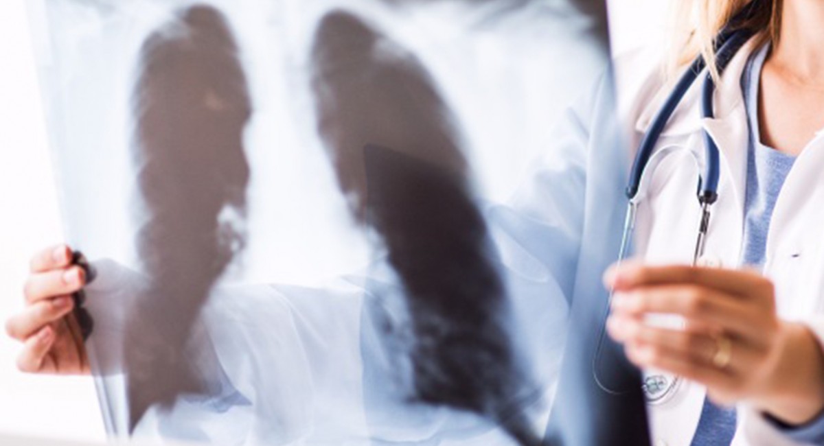 Smog widziany oczami lekarza. Myślenicki Alarm Smogowy publikuje komentarz Agaty Krzywoń