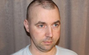 Zbyszek potrzebuje pomocy. Guz mózgu zaatakował ponownie!