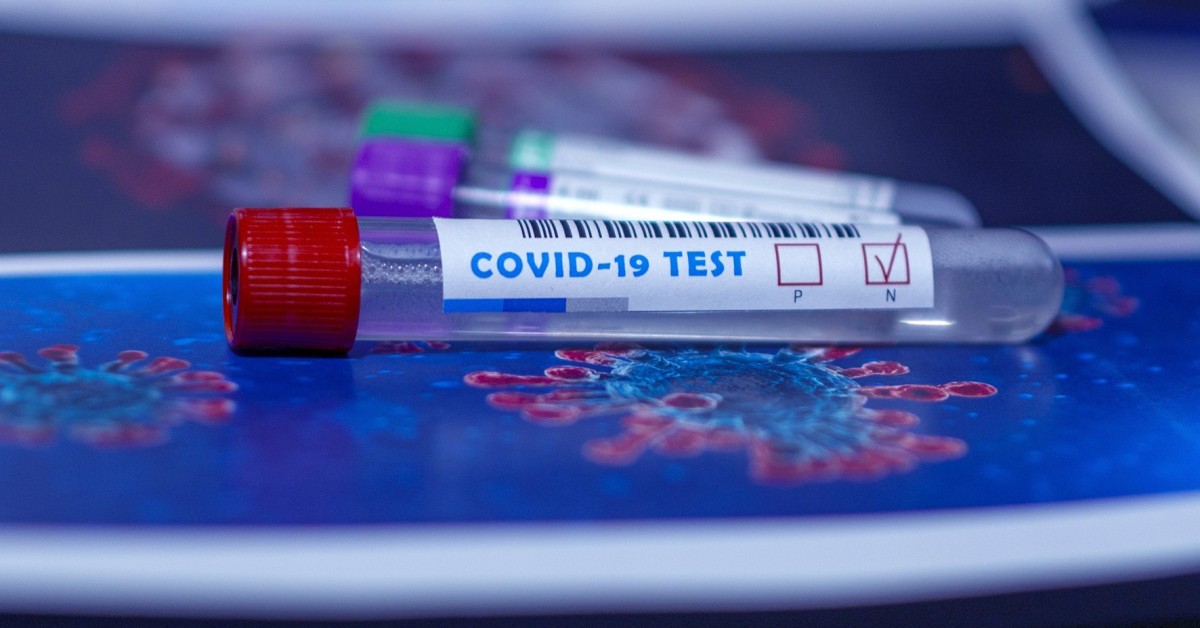 Nowe zasady testowania w kierunku koronawirusa. Od 1 kwietnia 2022 r. COVID-19 będzie traktowany jak grypa?