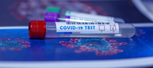 Nowe zasady testowania w kierunku koronawirusa. Od 1 kwietnia 2022 r. COVID-19 będzie traktowany jak grypa?